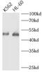 Telomeric repeat-binding factor 1 antibody, FNab08597, FineTest, Western Blot image 