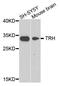 Thyrotropin Releasing Hormone antibody, MBS9128104, MyBioSource, Western Blot image 