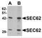 SEC62 Homolog, Preprotein Translocation Factor antibody, NBP2-81813, Novus Biologicals, Western Blot image 