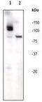Poly(ADP-Ribose) Polymerase 1 antibody, GTX61031, GeneTex, Western Blot image 