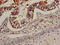 C-C Motif Chemokine Receptor 7 antibody, LS-C669816, Lifespan Biosciences, Immunohistochemistry frozen image 