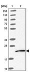 Ubiquitin Conjugating Enzyme E2 G1 antibody, NBP2-13500, Novus Biologicals, Western Blot image 