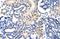 EMG1 N1-Specific Pseudouridine Methyltransferase antibody, A08458, Boster Biological Technology, Immunohistochemistry paraffin image 