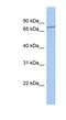 ENTH Domain Containing 1 antibody, NBP1-70483, Novus Biologicals, Western Blot image 