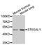 ST6 Beta-Galactoside Alpha-2,6-Sialyltransferase 1 antibody, A5754, ABclonal Technology, Western Blot image 