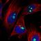 Zinc Finger Protein 519 antibody, HPA028982, Atlas Antibodies, Immunofluorescence image 