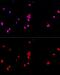 Eukaryotic Translation Initiation Factor 2 Subunit Alpha antibody, GTX64363, GeneTex, Immunocytochemistry image 