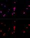 Eukaryotic translation initiation factor 2 subunit 1 antibody, GTX64363, GeneTex, Immunocytochemistry image 