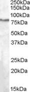 SEL1L Adaptor Subunit Of ERAD E3 Ubiquitin Ligase antibody, EB08567, Everest Biotech, Western Blot image 