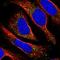 Transmembrane anterior posterior transformation protein 1 antibody, NBP2-58271, Novus Biologicals, Immunofluorescence image 