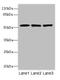 Integrator Complex Subunit 11 antibody, LS-C675582, Lifespan Biosciences, Western Blot image 