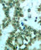 Protein Kinase C Theta antibody, LS-C335914, Lifespan Biosciences, Immunohistochemistry frozen image 