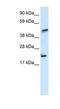 IKAROS Family Zinc Finger 5 antibody, NBP1-80021, Novus Biologicals, Enzyme Linked Immunosorbent Assay image 