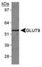 Solute Carrier Family 2 Member 9 antibody, PA5-22960, Invitrogen Antibodies, Western Blot image 