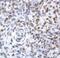 Zinc Finger Protein 500 antibody, PA1-24397, Invitrogen Antibodies, Immunohistochemistry paraffin image 