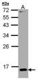 Retinol Binding Protein 1 antibody, PA5-28713, Invitrogen Antibodies, Western Blot image 