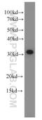 SAP domain-containing ribonucleoprotein antibody, 15798-1-AP, Proteintech Group, Western Blot image 