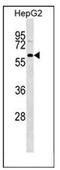 GDNF Family Receptor Alpha 3 antibody, AP51825PU-N, Origene, Western Blot image 