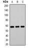 Transglutaminase 2 antibody, orb388709, Biorbyt, Western Blot image 