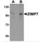 Zinc Finger MIZ-Type Containing 2 antibody, MBS151249, MyBioSource, Western Blot image 