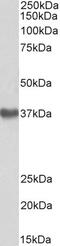 Fibrinogen Gamma Chain antibody, 43-681, ProSci, Western Blot image 