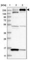 ArfGAP With RhoGAP Domain, Ankyrin Repeat And PH Domain 2 antibody, PA5-57465, Invitrogen Antibodies, Western Blot image 