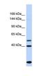Pleckstrin And Sec7 Domain Containing 3 antibody, orb325013, Biorbyt, Western Blot image 