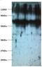 Ribosomal Protein S6 Kinase B2 antibody, MBS719433, MyBioSource, Western Blot image 