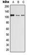 Desmoglein 4 antibody, GTX55984, GeneTex, Western Blot image 