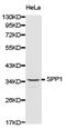 Secreted Phosphoprotein 1 antibody, LS-C192908, Lifespan Biosciences, Western Blot image 