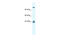 Glutamate Ionotropic Receptor NMDA Type Subunit 2C antibody, 28-230, ProSci, Western Blot image 