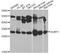 SURF1 Cytochrome C Oxidase Assembly Factor antibody, LS-C747618, Lifespan Biosciences, Western Blot image 