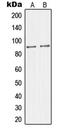 Mitogen-Activated Protein Kinase 8 Interacting Protein 2 antibody, LS-C353357, Lifespan Biosciences, Western Blot image 