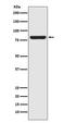 Signal Transducer And Activator Of Transcription 5A antibody, M01087-1, Boster Biological Technology, Western Blot image 