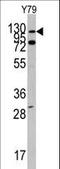 ABL Proto-Oncogene 1, Non-Receptor Tyrosine Kinase antibody, LS-C99161, Lifespan Biosciences, Western Blot image 