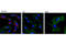 Platelet Derived Growth Factor Receptor Alpha antibody, 8893S, Cell Signaling Technology, Immunofluorescence image 