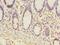 ER Membrane Protein Complex Subunit 6 antibody, LS-C376892, Lifespan Biosciences, Immunohistochemistry paraffin image 