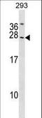 Synaptogyrin-2 antibody, LS-C161642, Lifespan Biosciences, Western Blot image 