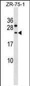 Coiled-Coil Domain Containing 140 antibody, PA5-71951, Invitrogen Antibodies, Western Blot image 