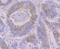 Ribonucleotide Reductase Catalytic Subunit M1 antibody, A01764-1, Boster Biological Technology, Immunohistochemistry frozen image 