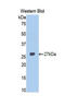 TNF Receptor Superfamily Member 14 antibody, LS-C296876, Lifespan Biosciences, Western Blot image 