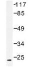 Ephrin A2 antibody, GTX30999, GeneTex, Western Blot image 