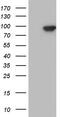 Tousled Like Kinase 2 antibody, TA805460, Origene, Western Blot image 