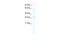 Spi-1 Proto-Oncogene antibody, 27-338, ProSci, Enzyme Linked Immunosorbent Assay image 