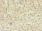 TBC1 Domain Family Member 20 antibody, CSB-PA846594LA01HU, Cusabio, Immunohistochemistry paraffin image 