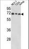 Abl Interactor 1 antibody, LS-B9337, Lifespan Biosciences, Western Blot image 