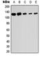 SUMO Specific Peptidase 6 antibody, orb234963, Biorbyt, Western Blot image 