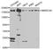 SWI/SNF Related, Matrix Associated, Actin Dependent Regulator Of Chromatin, Subfamily A, Member 4 antibody, MBS127528, MyBioSource, Western Blot image 