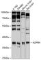ADP-Ribosylarginine Hydrolase antibody, GTX30028, GeneTex, Western Blot image 