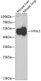Hyaluronidase 1 antibody, GTX64626, GeneTex, Western Blot image 